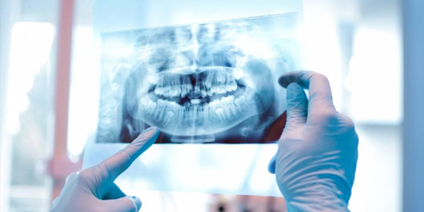 Dentist in blue gloves examining dental X-ray of patient's teeth on digital display.